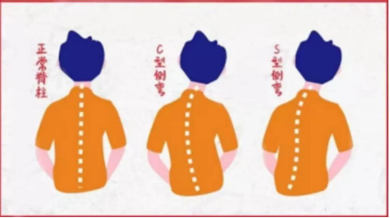 163735v2mlsseg625m5t5t.png